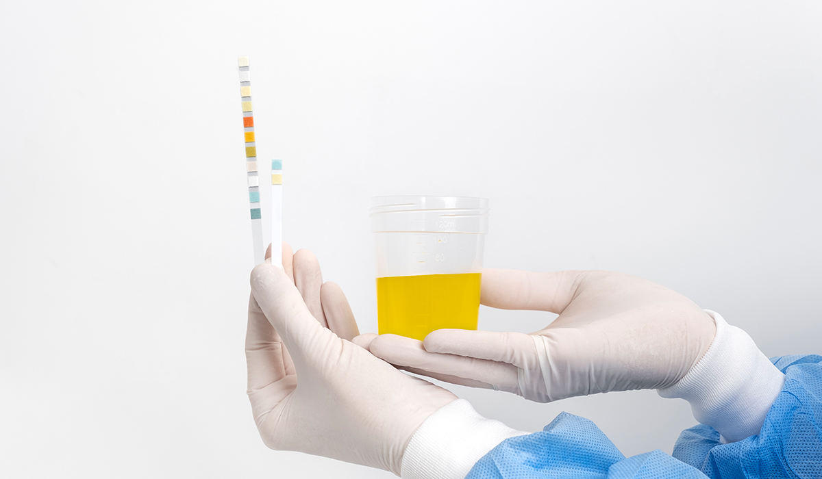 Urine Testing